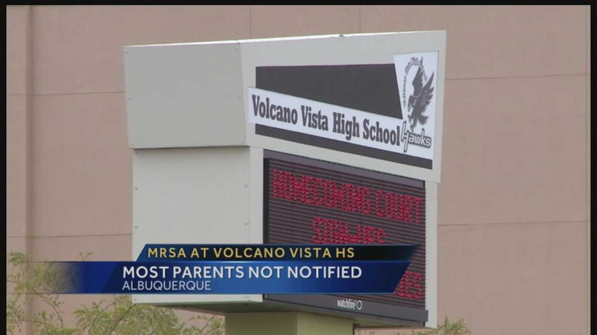 MRSA at Volcano Vista High School