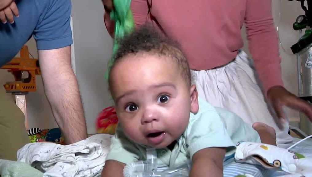 Miracle Florida baby born twice after groundbreaking surgery