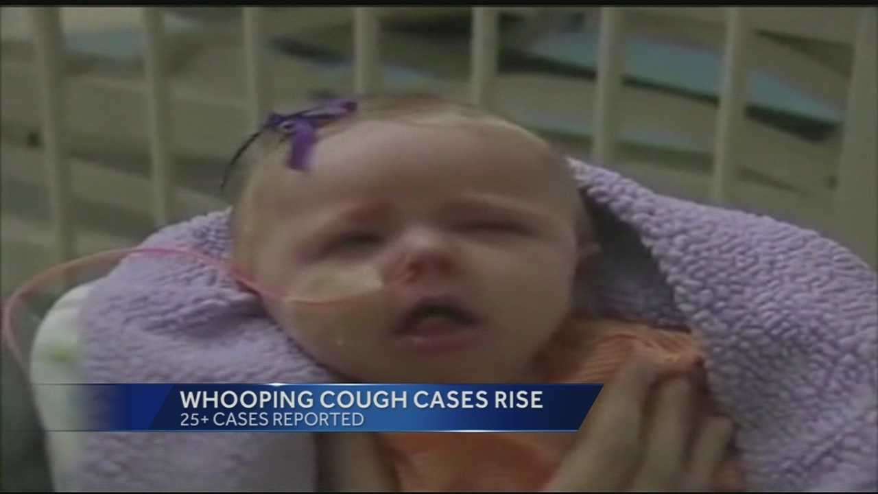 Whooping Cough Cases On The Rise