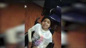 Girl burned in fire making speedy recovery