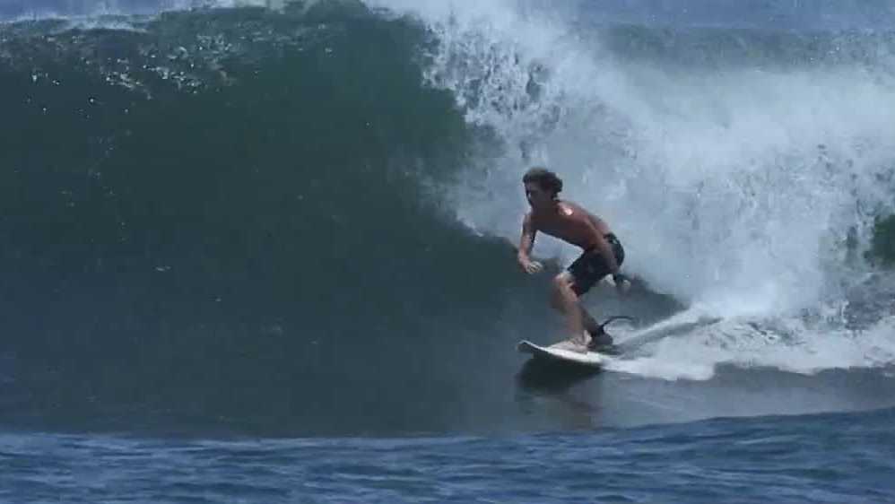 'I felt this pressure on my arm' Teen survives shark bite at Brevard