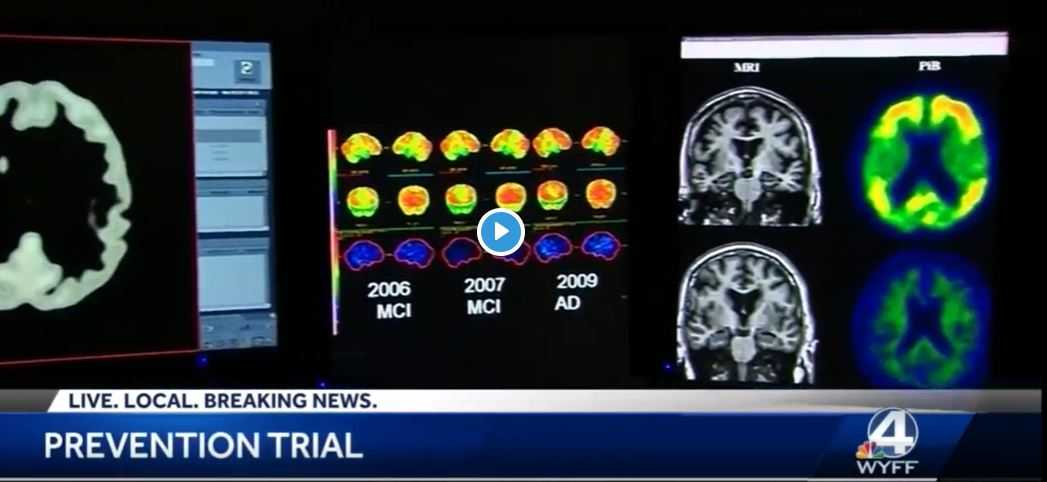 Preventing Alzheimer's Disease Is Goal Of Breakthrough Therapy