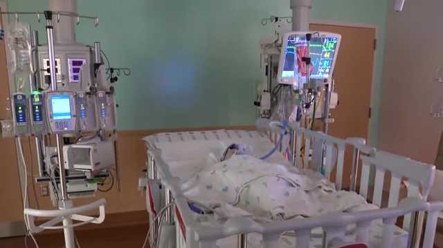 Children's Wisconsin RSV hospitalizations skyrocket - Vimarsana News