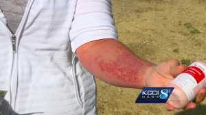 Here’s what to do if you touch wild parsnip