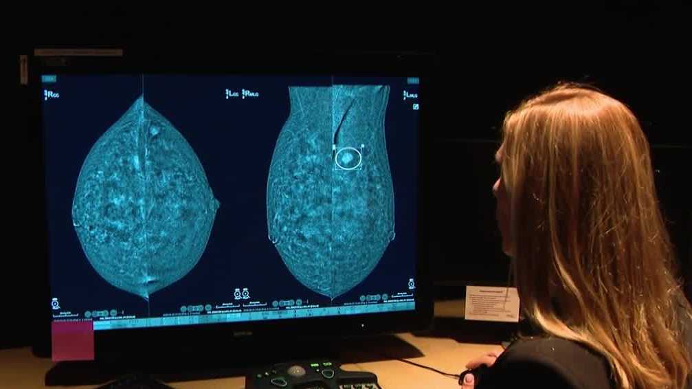 Pittsburgh woman says advanced mammogram technology detected cancer missed by routine screening