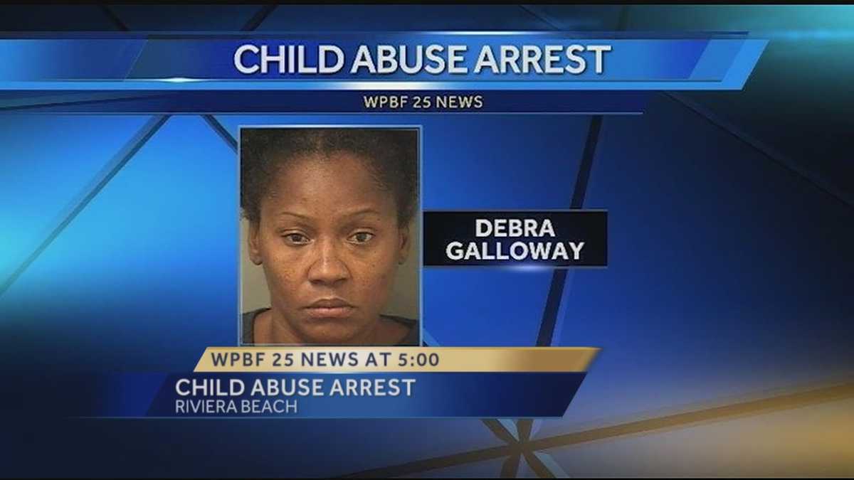 Police investigating case of severe child abuse