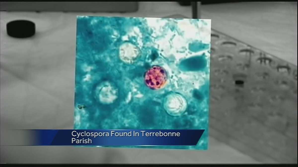 Rare stomach bug confirmed in La.