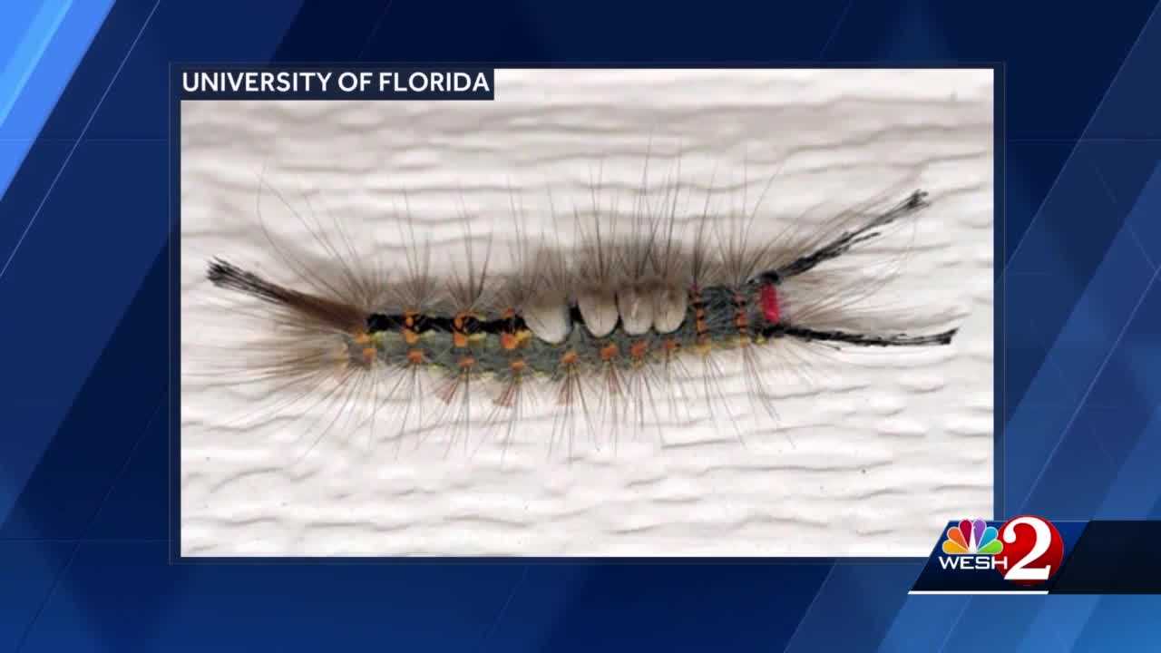 Officials warn of fuzzy caterpillars that leave stinging rashes