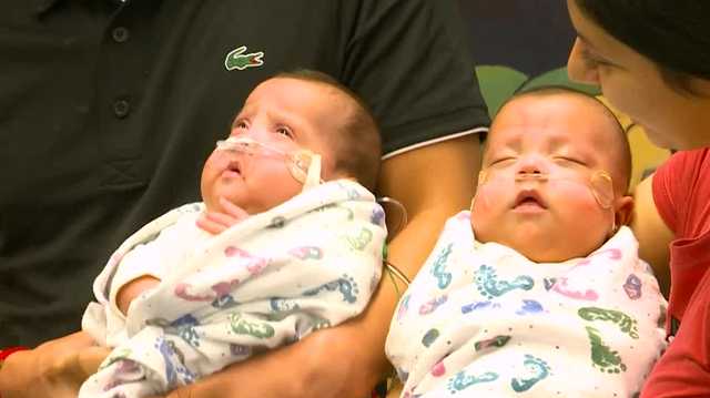 Iowa babies born at 22 weeks are heading home healthy - Vimarsana News