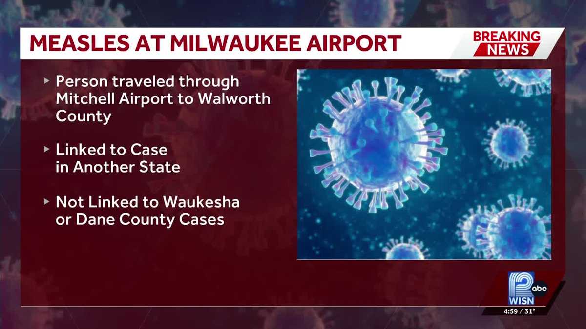 Person with confirmed case of measles traveled through Mitchell International
