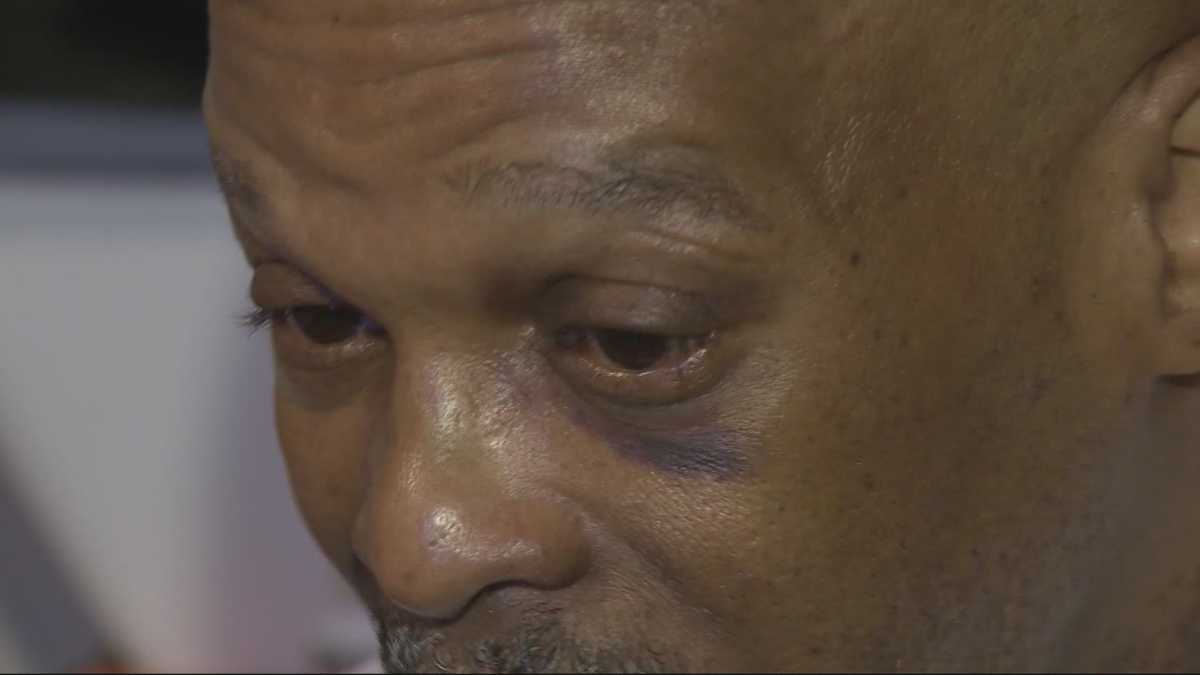 Man punched, knocked out in the middle of busy street