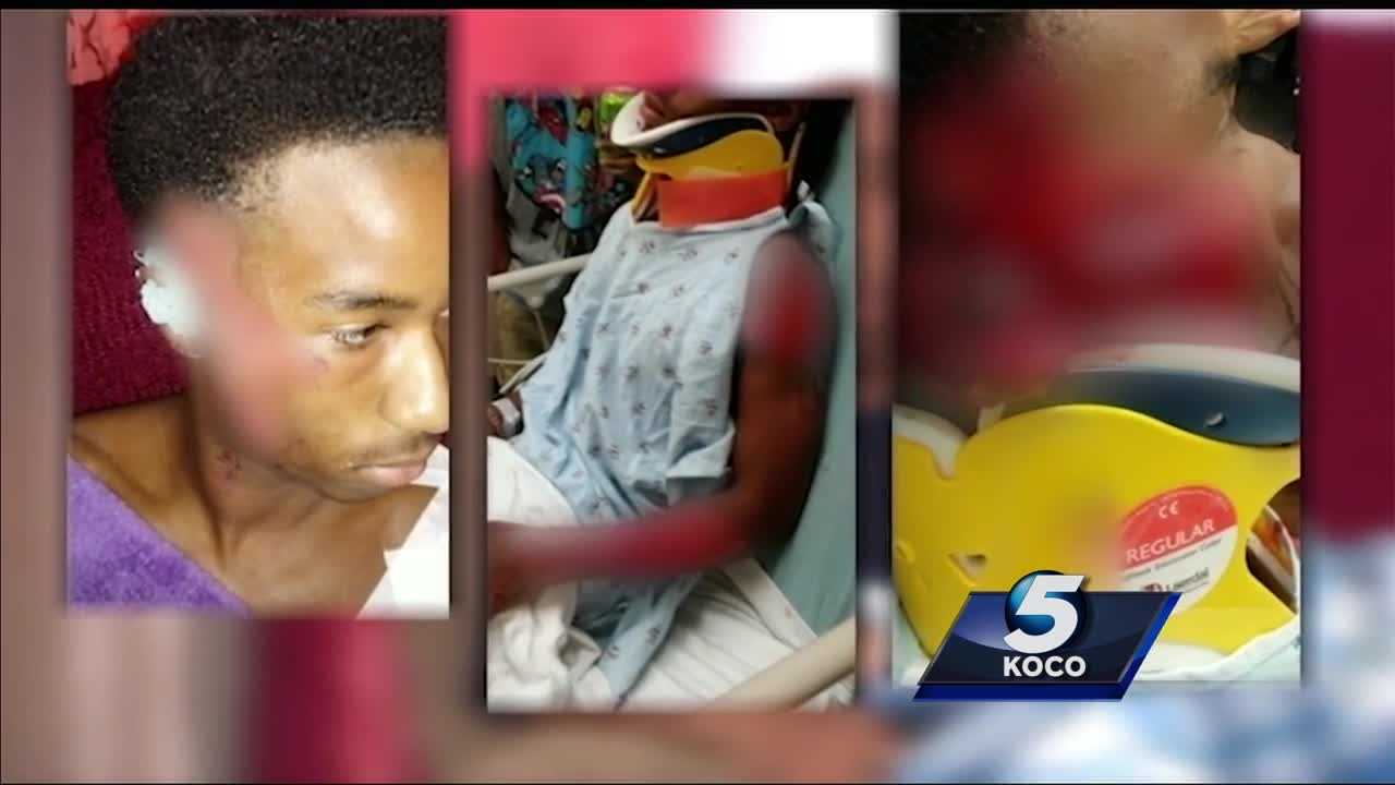 Heartbroken Mother Speaks Out After Son Injured In Hit-and-run Crash