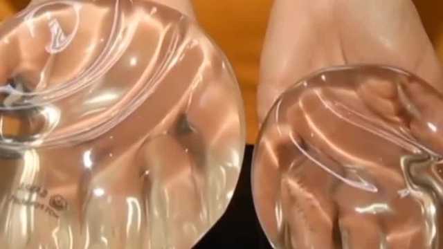 The Woman's Doctor: Breast feeding with implants