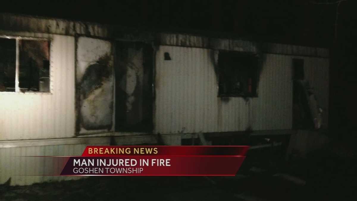 Man suffers burns in mobile home fire