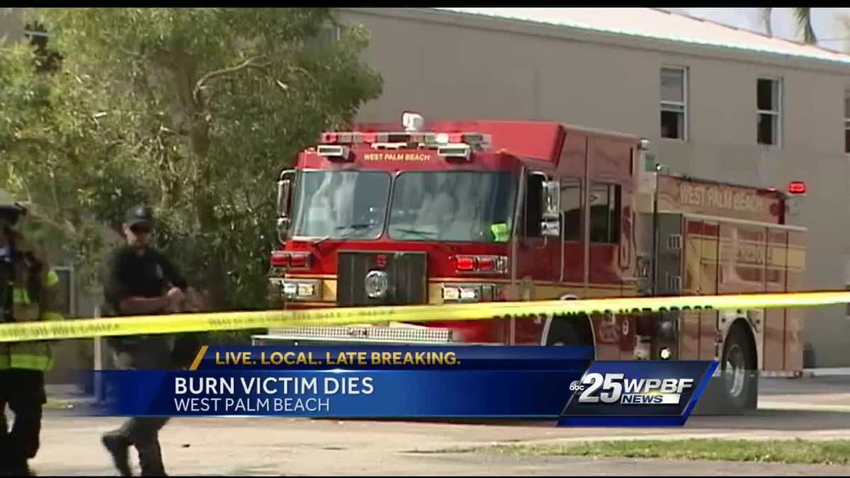 West Palm Beach burn victim dies