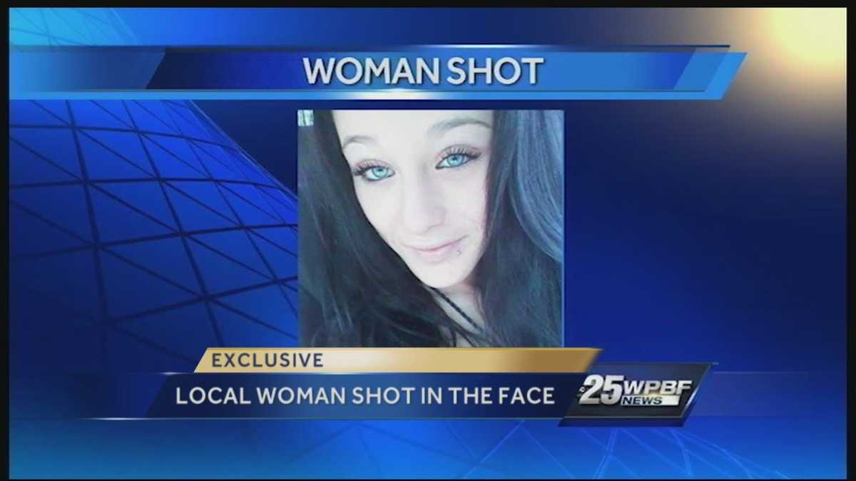 Local woman shot in the face