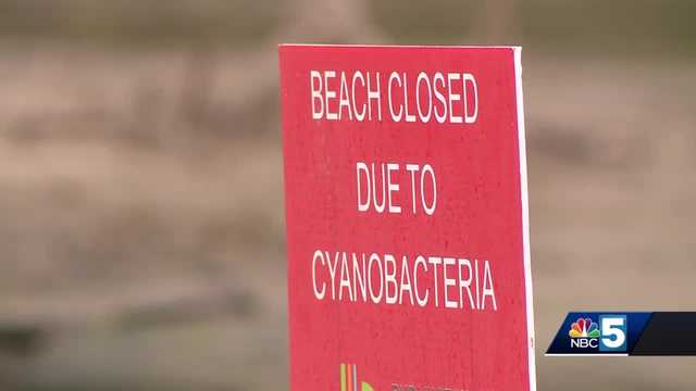 Burlington beaches closed due to cyanobacteria blooms - Vimarsana News
