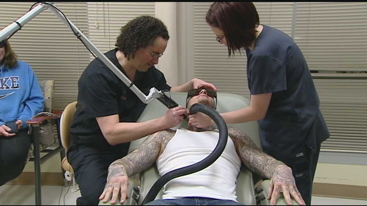 Plastic surgeon removing tattoos for convicted felons
