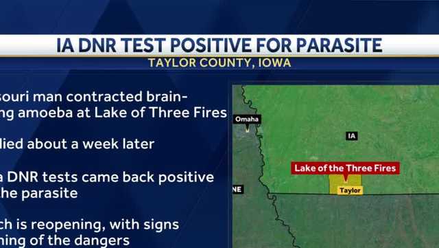 Iowa Department of Natural Resources confirms brain-eating amoebas - Vimarsana News