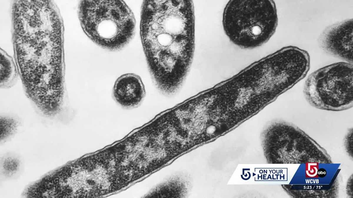 Doc talks Legionnaires after 3 killed, dozens hospitalized from disease in NYC