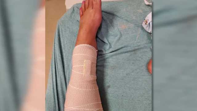 Woman attacked by shark in Volusia County recounts attack - Vimarsana News