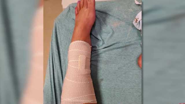 Woman attacked by shark in Volusia County recounts attack - Vimarsana News