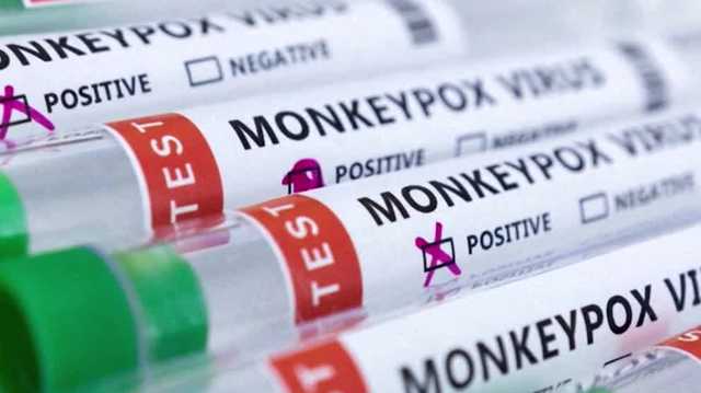 What monkeypox public health emergency means for Massachusetts - Vimarsana News