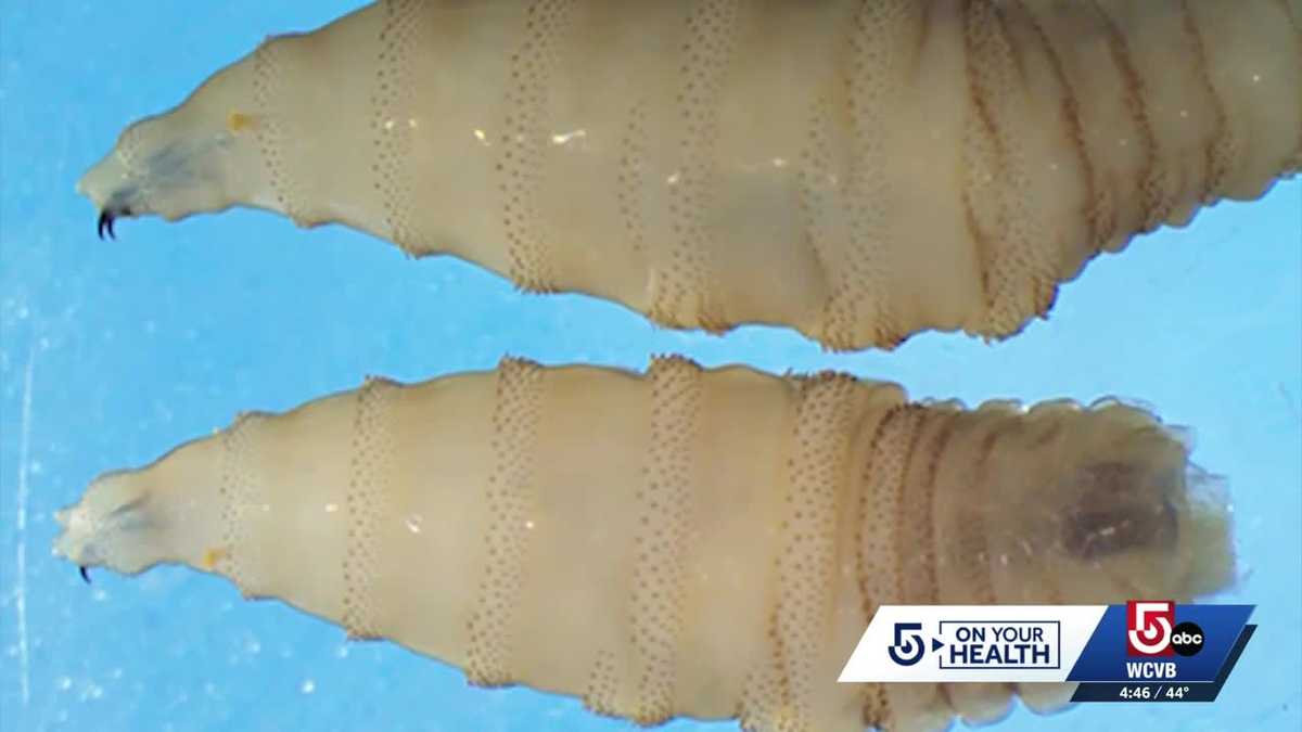 Will the New World Screwworm parasite pose a threat to Massachusetts? Doctor explains.