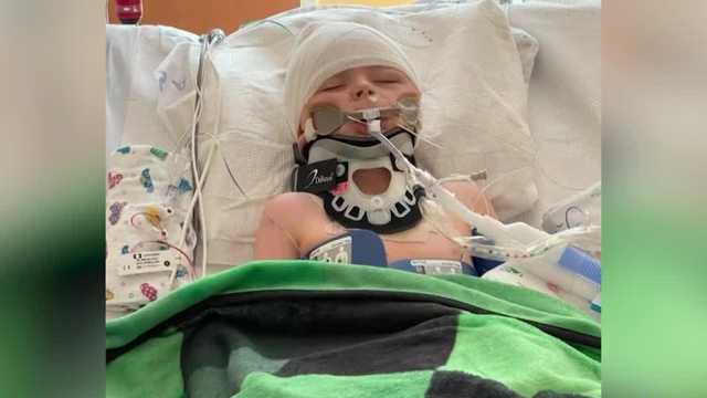 Boy in coma after rock kicked by lawn mower hit him in head - Vimarsana News