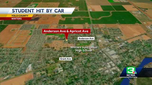 Student hit by car while crossing street for school in Winters - Vimarsana News