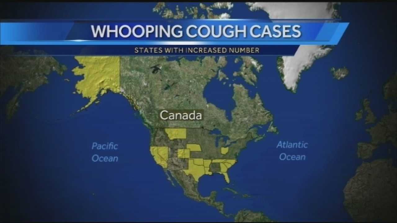 Whooping Cough Cases On The Rise In Arkansas