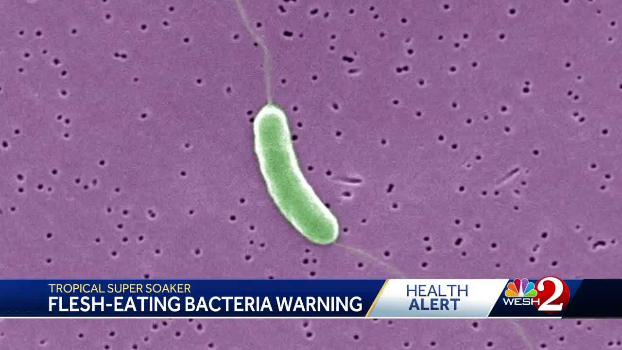 4 dead from flesh eating bacteria - 6c4ead79 B766 42fe Ae0e 2dccb81c41e9