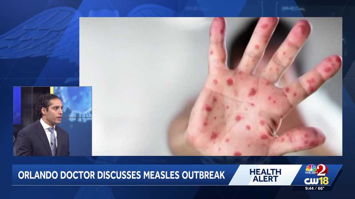 Central Florida doctor explains signs, symptoms, likely cause for surge ...