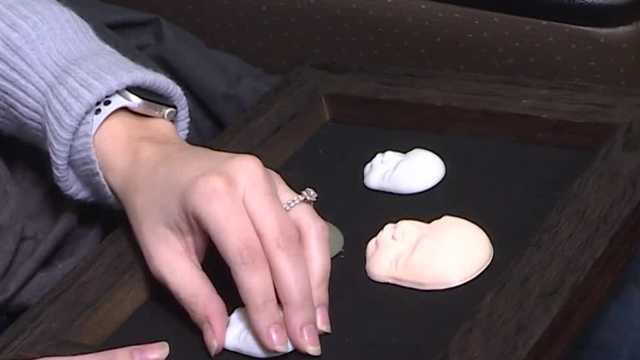 Omaha doctors give 3D printed ultrasound to expecting mother - Vimarsana News