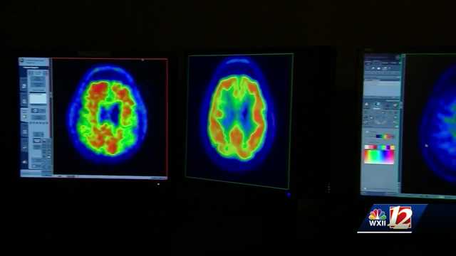 Doctor talks frontotemporal dementia after Bruce Willis diagnosed - Vimarsana News