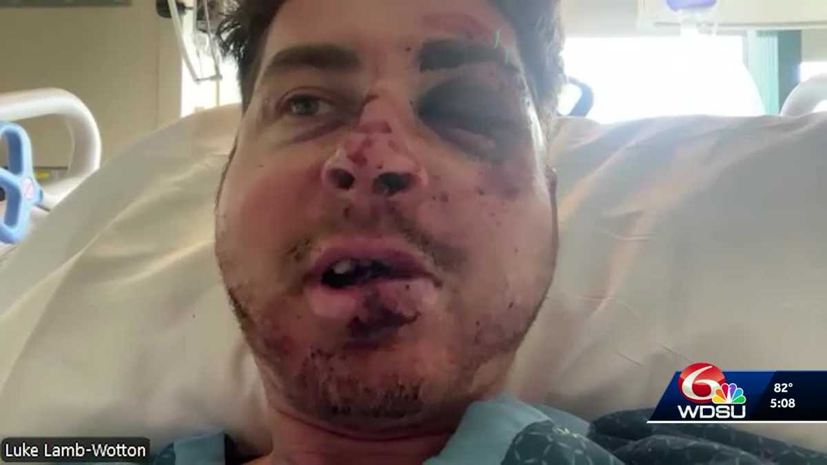 New Orleans man who fell while mountain climbing describes the moment he was rescued
