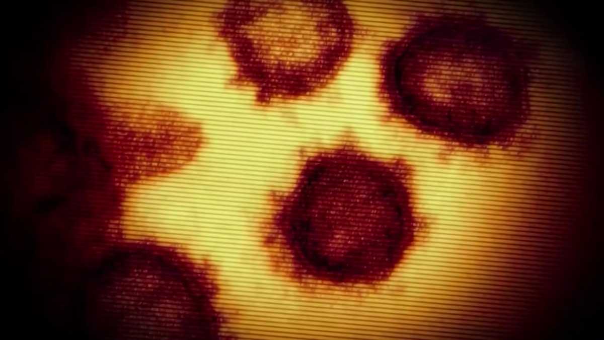 Massachusetts COVID19 cases rising, but doctors aren't alarmed