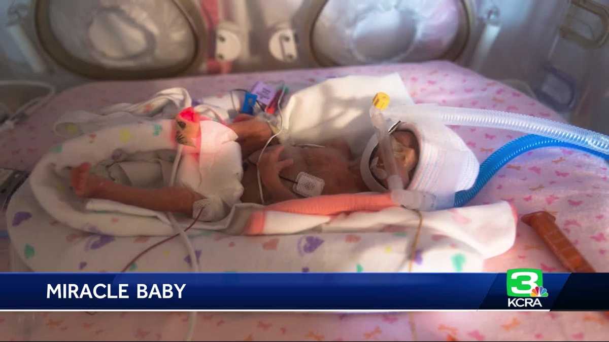 Miracle premature baby goes home on ‘due date’