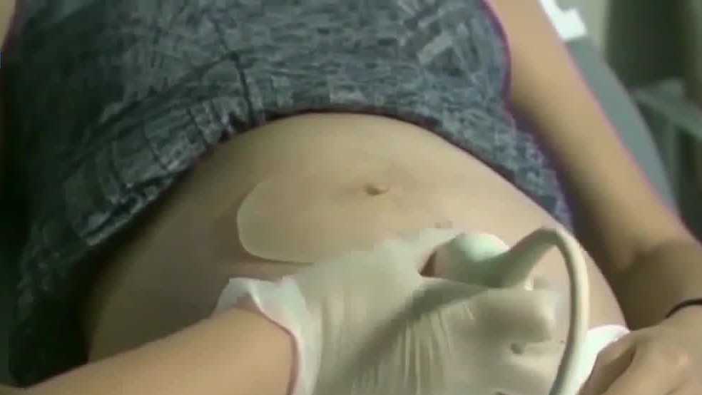 Iowans rally for abortion ban proposal at Capitol Rotunda