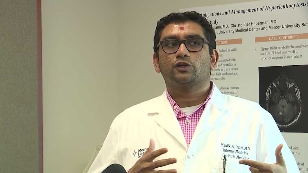 Savannah doctor breaks down COVID19 diagnosis for someone over 65