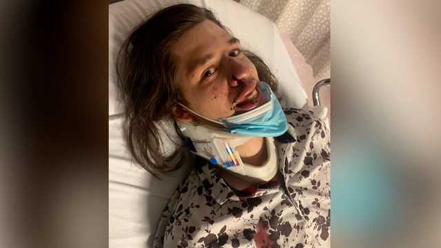 3 of 4 teens face judge in violent attack on local musician in Boston - Vimarsana News