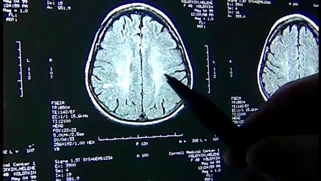 MGH study links lockdown-related mental health symptoms to inflammation - Vimarsana News