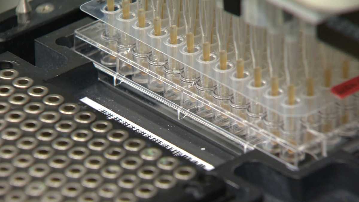Blood test could detect cancer before symptoms show