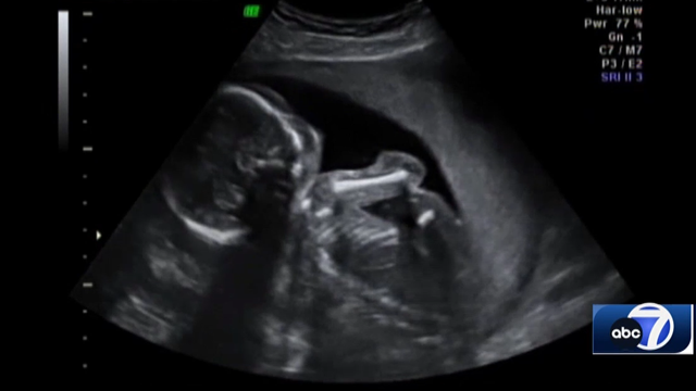 Women caught off guard as Florida's 6-week abortion law goes into effect - Vimarsana News