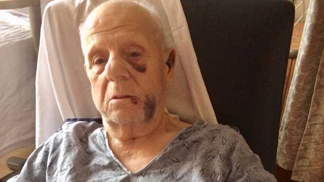 Elderly driver attacked by dirt bike, ATV riders in Boston - Vimarsana News
