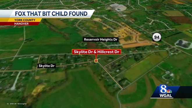 Police kill fox that bit child