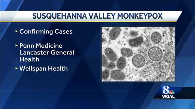 Two health systems confirm Susquehanna Valley monkeypox cases - Vimarsana News