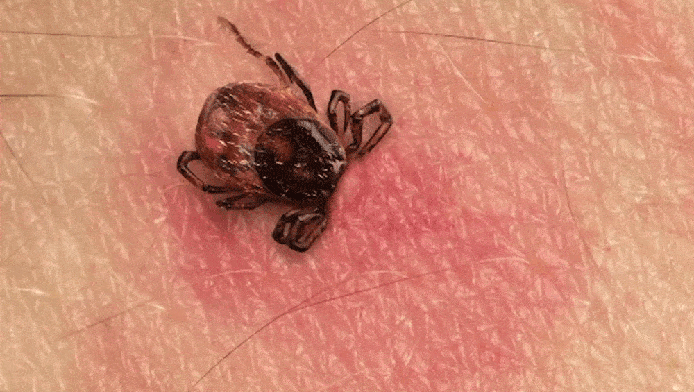 What you need to know about Bourbon virus, other tickborne diseases