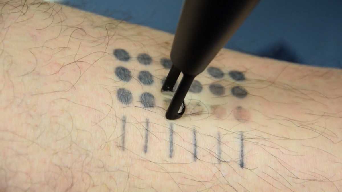Massachusetts company creates cuttingedge tattoo ink that can disappear