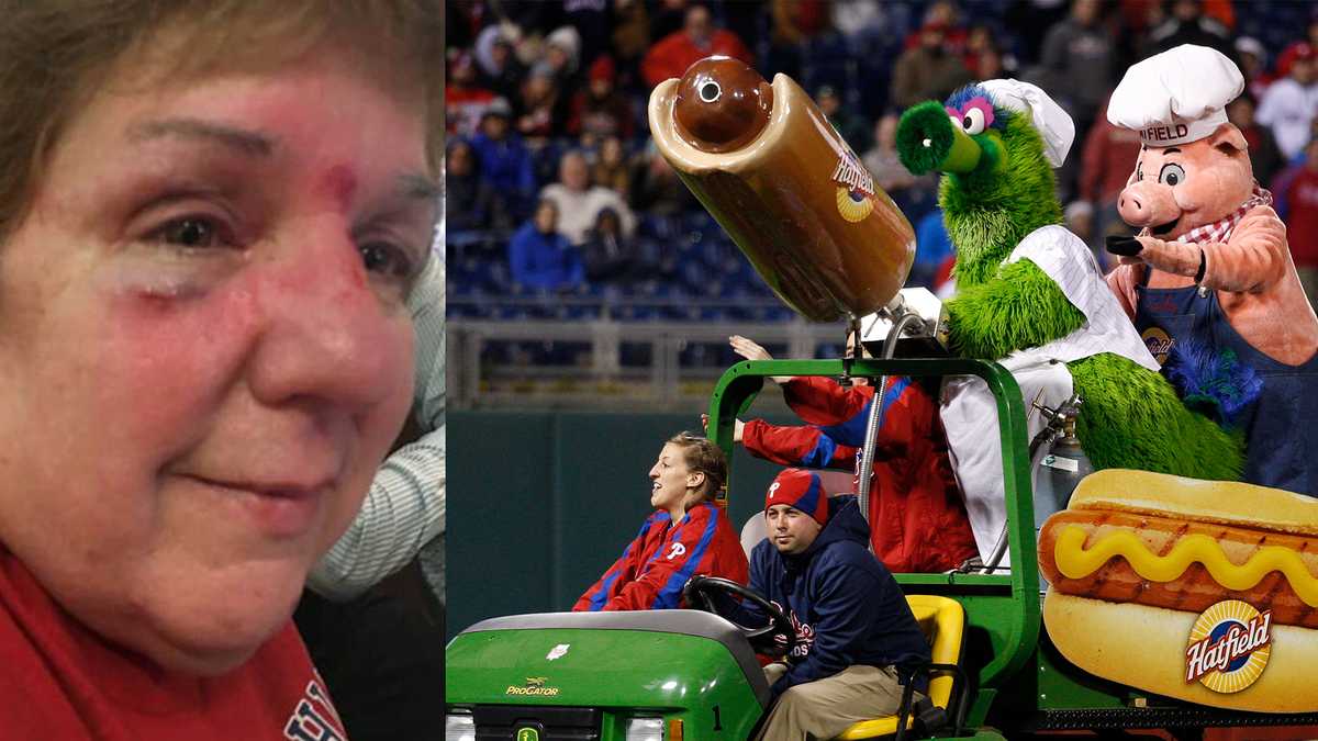 Flying hot dog hurts fan: 'It just came out of nowhere And hard!